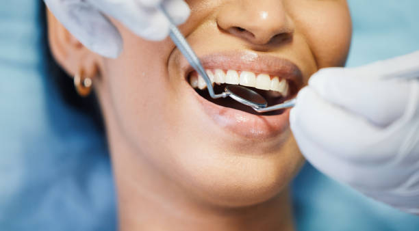 Best Root Canal Treatment  in Key Vista, FL